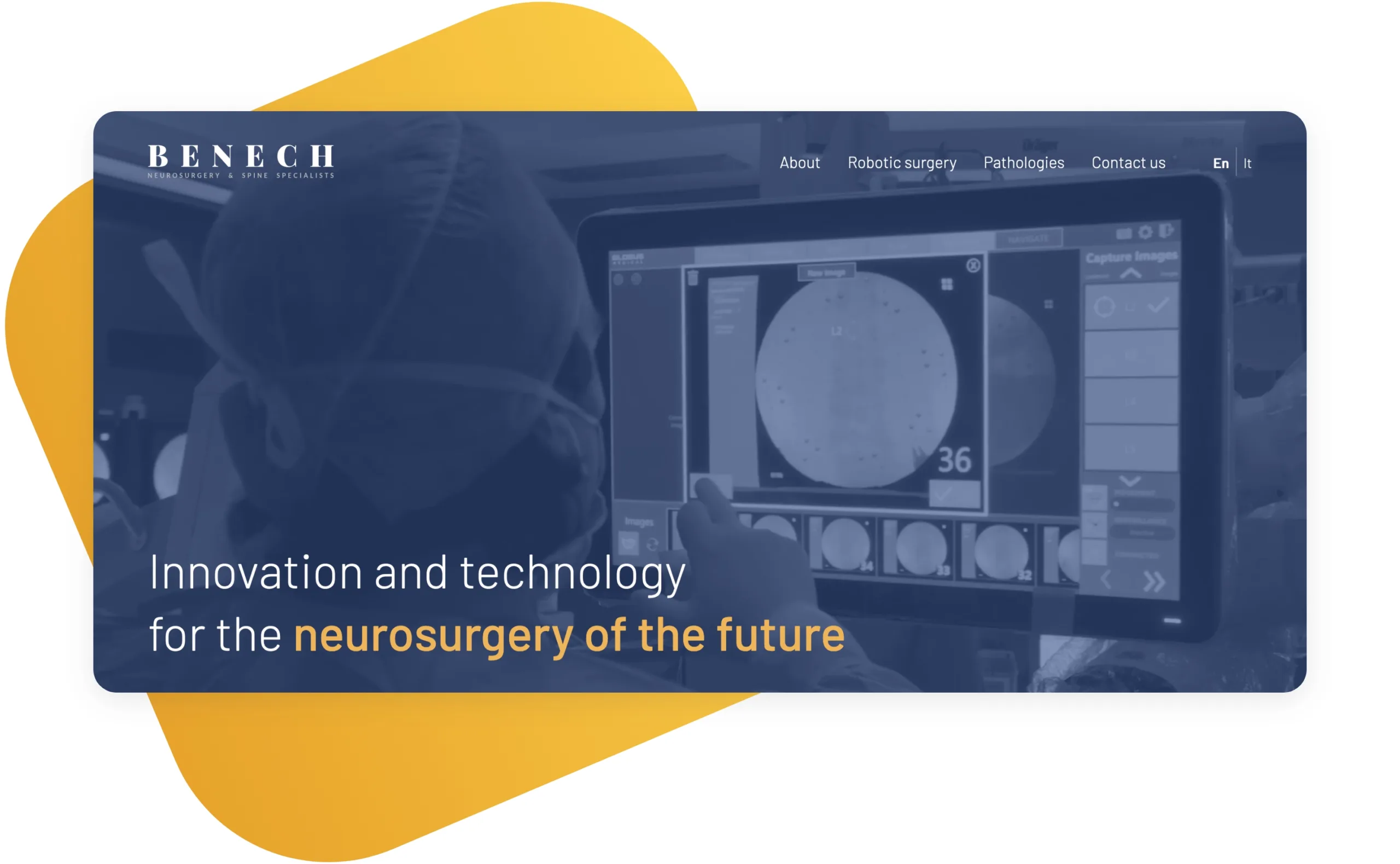 Top 25 Inspirationally Designed Drupal Websites of 2022 27 25-Benech Neurosurgery.jpg